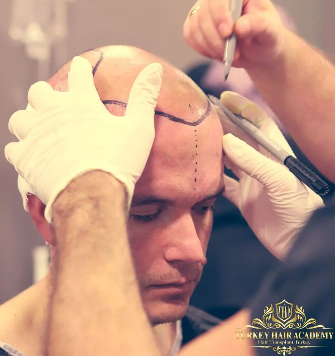 Turkey Hair Academy Clinic