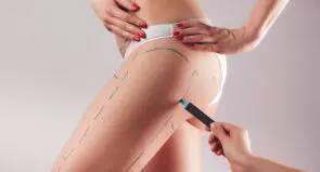 Когда требуется подтяжка внутренней стороны бедра: показания и особенности процедуры