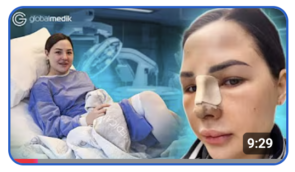 Rhinoplasty in Turkey + breast augmentation