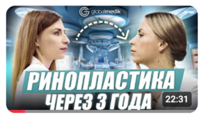 Rhinoplasty in Turkey: review after three year