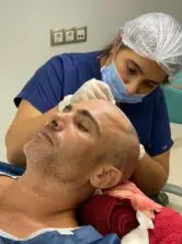 Трансплантация волос