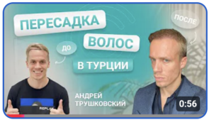 Пересадка волос Андрею Трушковскому