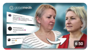 Подтяжка лица в Турции