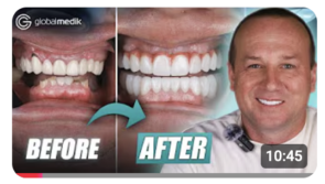 A Hollywood Smile in Turkey