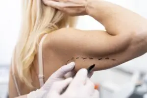 Все про липэктомию