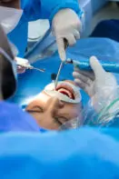 Dentistry in Turkey. Healthy teeth under general anesthesia