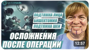SMAS подтяжка лица в 50 лет: личный опыт Марины 