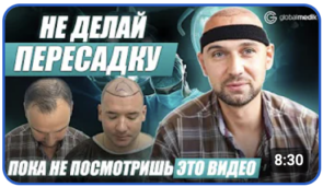 Как проходит пересадка волос в Стамбуле?