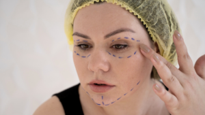 Блефаропластика: наскільки довговічний результат і кому підходить ця операція?