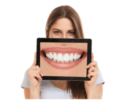 Hollywood Smile in Turkey: How the Procedure Works