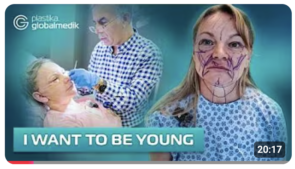 Full Facelift in Istanbul | Our Patient's Journey