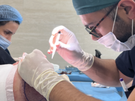 Does Hair Transplant Hurt? Honest Answer from a Doctor