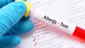 Диагностика аллергии: анализы и пробы