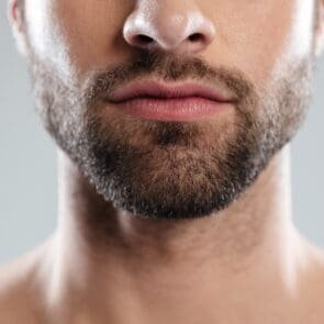 Пересадка бороди та вусів