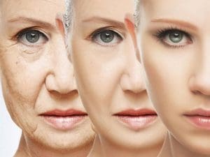 Forehead and Brow Skin Lift – Aesthetic Front Lift in Turkish Clinics