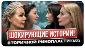 Rhinoplasty in Turkey