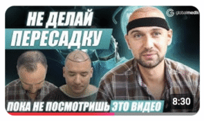 Как проходит пересадка волос в Стамбуле? 