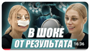 Блефаропластика и ринопластика в Турции