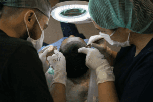 Where is the Best Place to Do Hair Transplant in the World